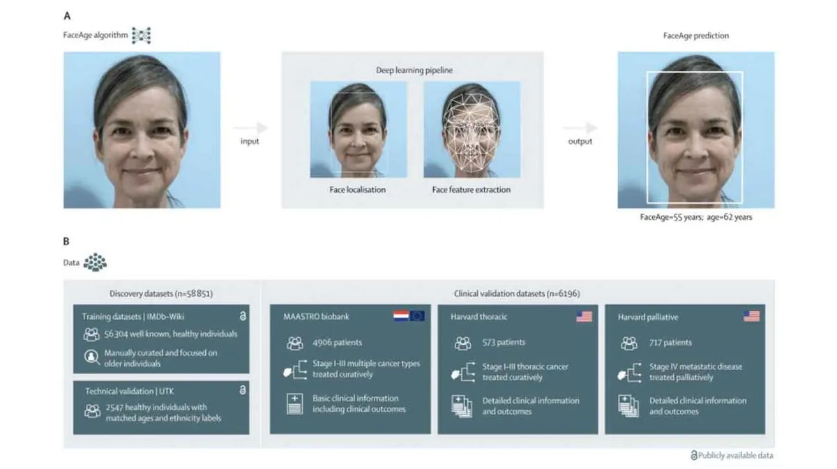 Pilt, mis illustreerib FaceAge algoritmi. Ülalt, osa A: naise nägu sisendi kohal, näo lokaliseerimise ja tunnuste tuvastamise etapid, mis viivad FaceAge ennustuseni, kus vanuseks hinnatakse 55 aastat, tegelik vanus 62 aastat. All, osa B: tabel andmekogumite kohta. Vasakul avastuskogumid, sealhulgas treening- ja tehniline valideerimine. Paremal kliinilised valideerimiskogumid, kus on esile toodud erinevad patsiendid ja haiglad koos vastavate andmetega.
